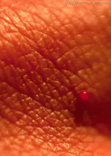blood-droplet